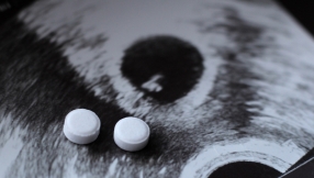 Culture change needed to reduce gargantuan abortion numbers, says peer