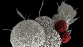 Cancer cure news 2017: The cure may just be in our digestive system