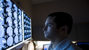 'World's heaviest' four-pound tumor removed from man's brain in seven-hour long operation