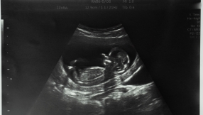 Poll shows little support for decriminalising abortion