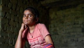 Foreign aid cuts leave Gen Alpha increasingly exposed to leprosy, Christian aid charity warns