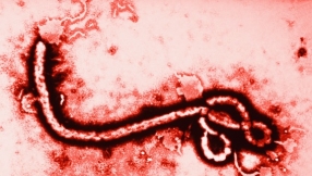 After Ebola arrives in Texas, the Catholic faithful are being asked to avoid kissing or shaking hands in church