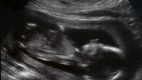 Feminist reportedly aborts baby because he was male: I couldn\'t bring a monster into this world