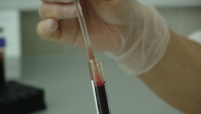 Cancer detection, identification: Blood tests for fetal abnormalities can also detect hidden cancers in pregnant women