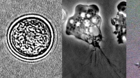 Louisiana tap water positive for brain-eating amoeba