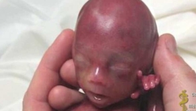 Live baby shown being killed and organs harvested by Planned Parenthood in 7th sting video: \'Kinda cool,\' says employee