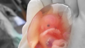 In Australia, abortion is just a phone call away; women can kill foetus themselves