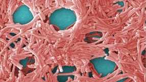 Legionnaire\'s disease outbreak source points to cooling towers