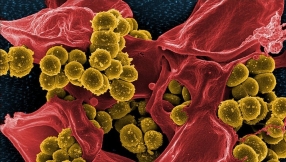 Breast cancer drug Tamoxifen offers hope in treatment of \'superbug\' infections