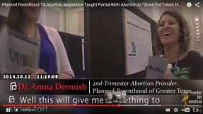 Abortionist vows to get intact baby head in latest Planned Parenthood sting video