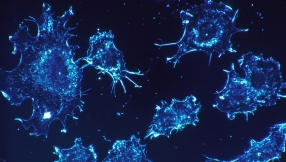 Pancreatic cancer treatment update: New medical breakthrough offers hope