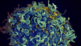 HIV cure update: Bionor\'s Vacc-4x/Romidepsin shows promise in reducing latent HIV reservoir, controlling viral load