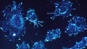 Cancer cure news and update: Promising therapy eliminates cancer symptoms, research finds