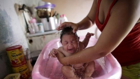 Larvicides and Zika virus update: Scientists debunk claims stating microcephaly is caused by larvicides