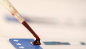 HIV, AIDS cure news 2016: New vaccine ready to start on human trials