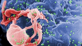 HIV/AIDS cure news: Stem cell transplantation being considered a possible albeit complicated approach