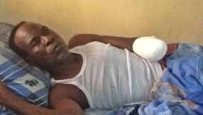 Nigerian pastor loses hand after he was attacked by Muslim Fulani herder