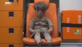 Brother of Syrian boy pictured in Aleppo dies of his wounds
