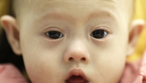 Why I Decided A Child With Down\'s Syndrome Was Not Right For My Family
